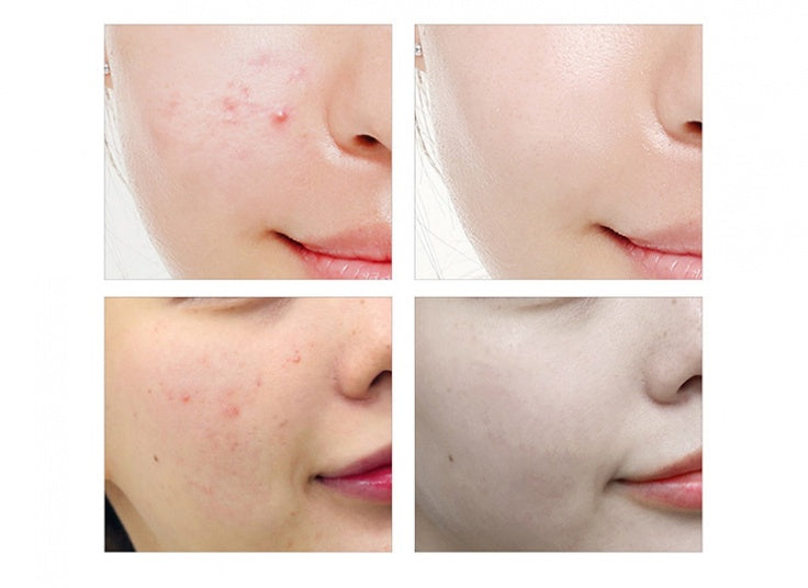💎 Oferta 2X1 | Mascarilla Dorada de Colágeno 💎