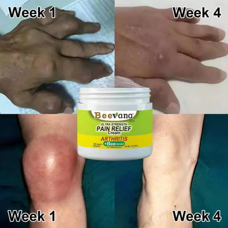 BEEVANA™🔥"¡COMPRE UNO Y LLEVE OTRO GRATIS!" CREMA PARA TERAPIA DE HUESOS Y ARTICULACIONES🤩RECUPERACIÓN COMPLETA